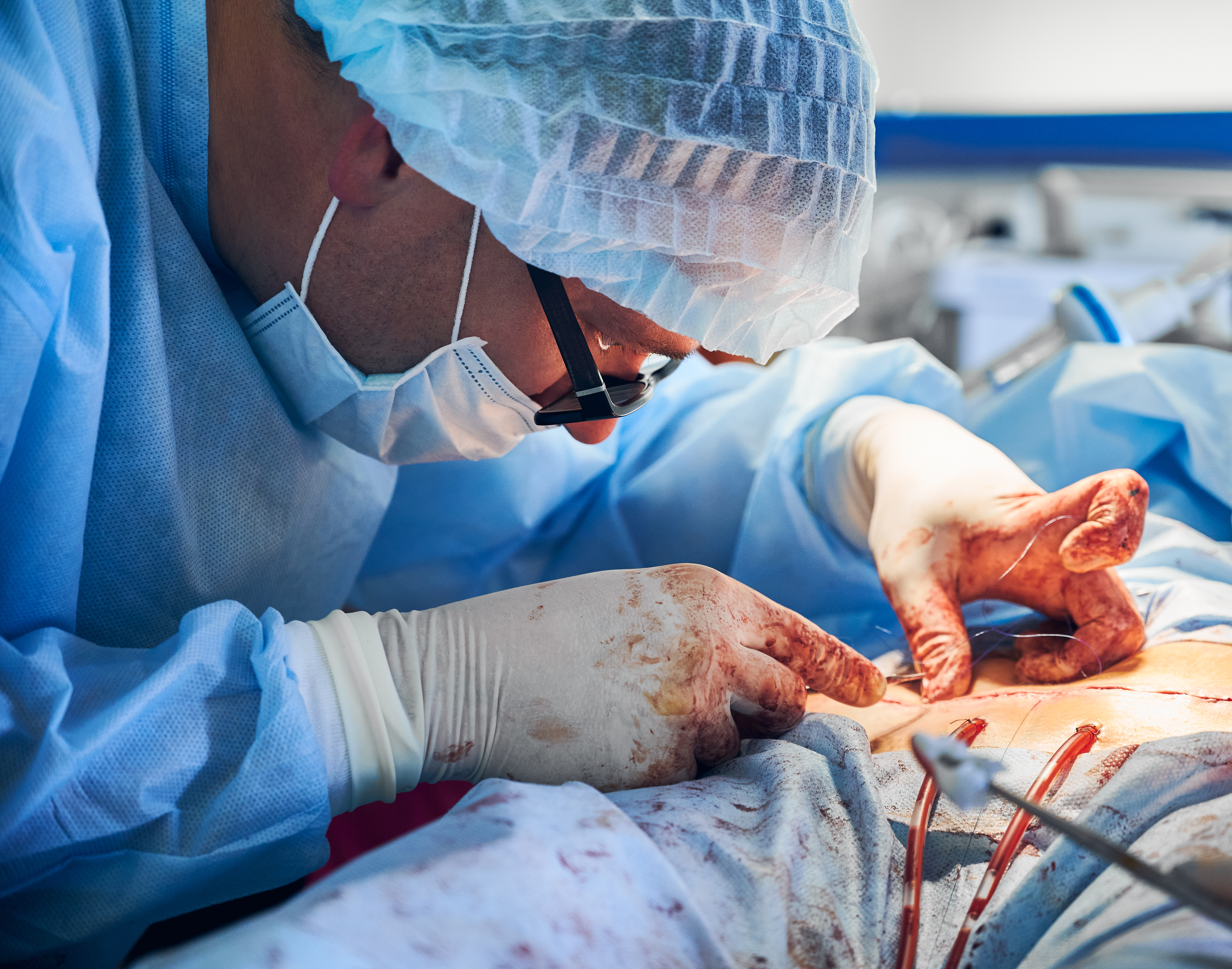 What is Heart Surgery with a Small Incision and What is it Not?